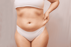 a patient discussing fat removal surgery