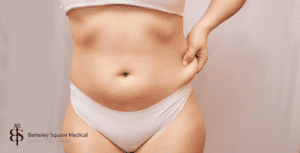 lipo is a fat loss surgery
