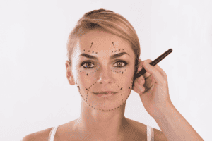 facelift patient during recovery