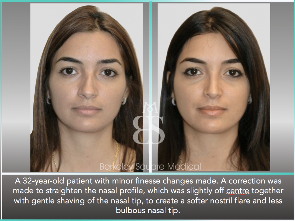 Patient11 Berkeley Square Medical Central London