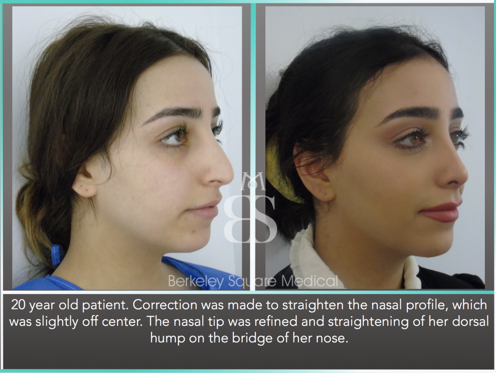 Patient1091 Berkeley Square Medical Central London