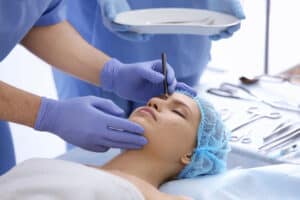 open vs closed rhinoplasty surgery