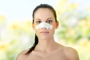 female rhinoplasty patient