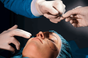 rhinoplasty surgery