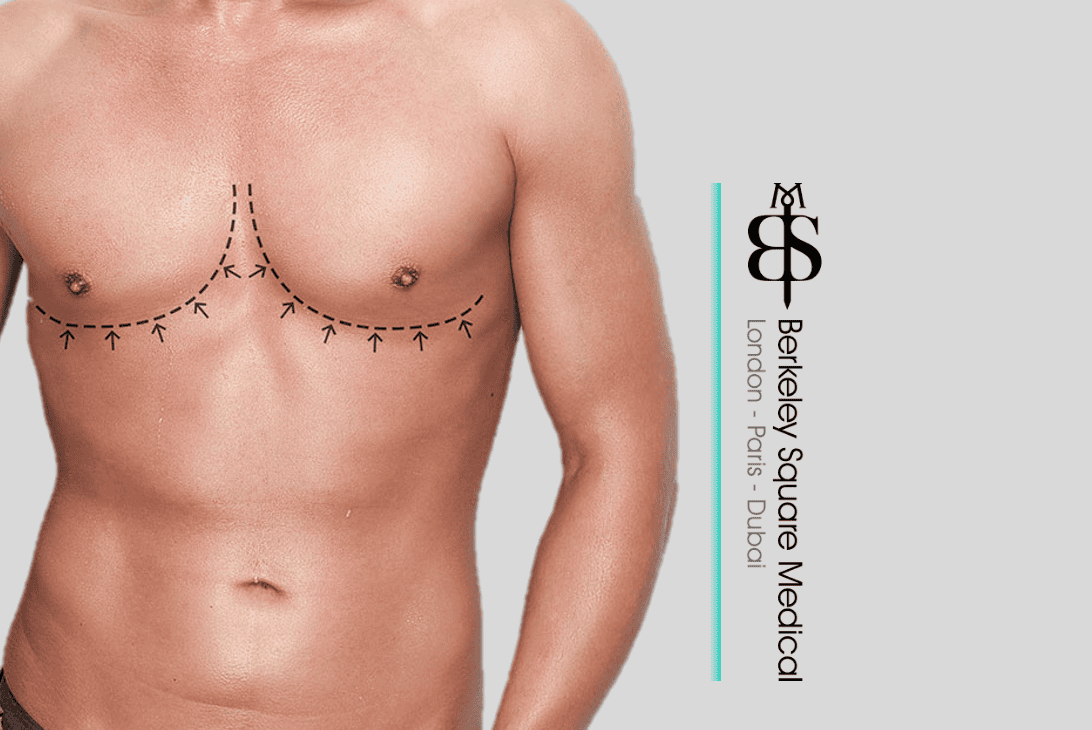 Berkeley Square Medical